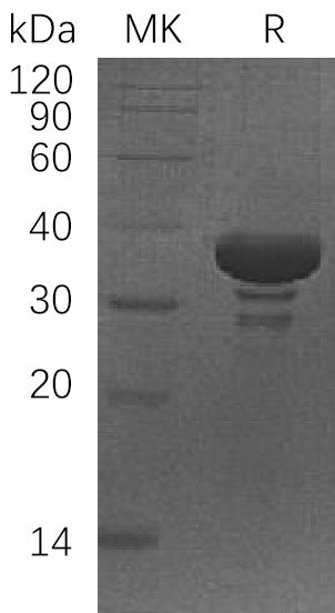 Recombinant Human SGTA (N-6His)