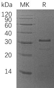 Recombinant Human ZMYND19 (N-6His)