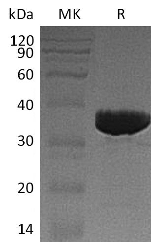 Recombinant Human GALM (C-6His)