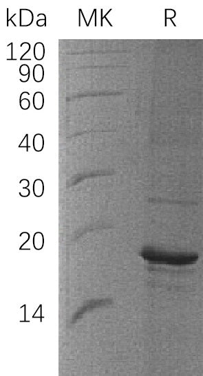 Recombinant Human ZBP1 (C-6His)