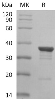 Recombinant Human AKR1C2