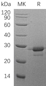 Recombinant Human MOB1A (C-6His)