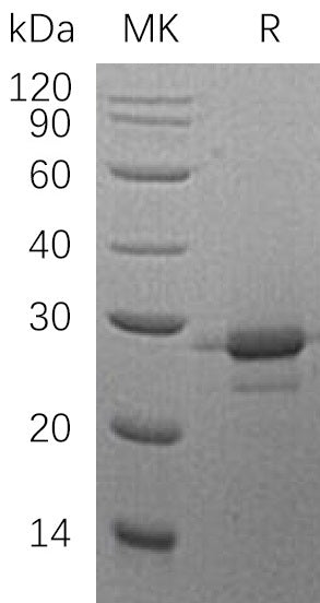 Recombinant Human MOB1A (C-6His)