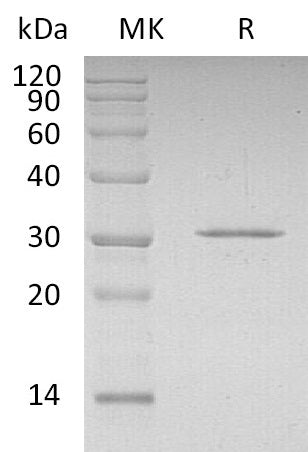 Recombinant Human CDKN1B (N-6His)