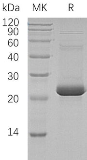 Recombinant Human ASF1A (C-6His, N-T7 tag)