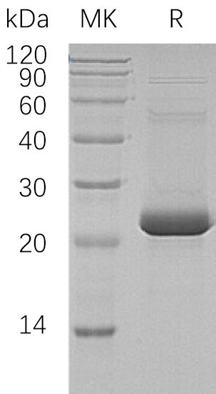 Recombinant Human ASF1A (C-6His, N-T7 tag)