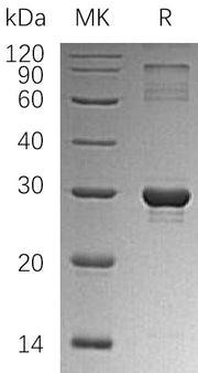 Recombinant Human HGPRT (N-6His)