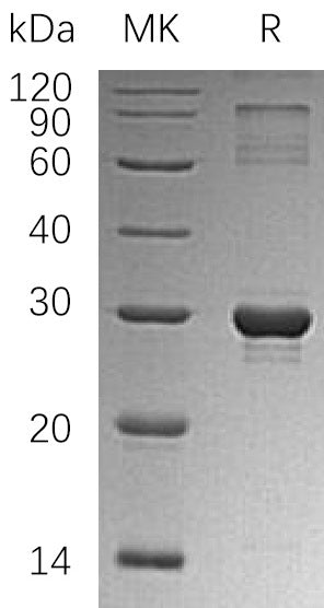 Recombinant Human HGPRT (N-6His)