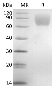 Recombinant Mouse TrkA (C-6His)