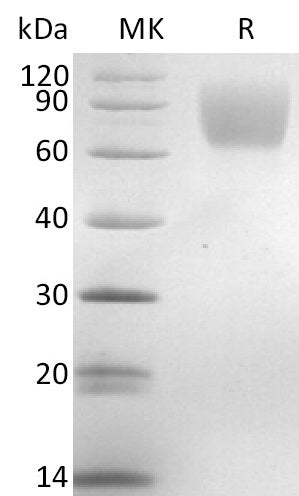 Recombinant Mouse TrkA (C-6His)