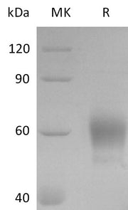 Recombinant Mouse IL-3RA (C-8His)