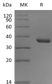 Recombinant Human CD9 (N-Fc)