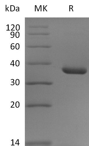 Recombinant Human CD9 (N-Fc)