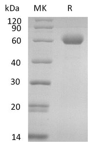 Recombinant Human CD39L1 (C-6His)