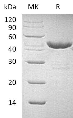 Recombinant Human GOT1 (C-6His)