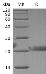 Recombinant Human LACRT (N-6His)