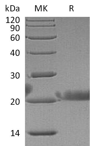 Recombinant Human LACRT (N-6His)