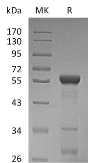 Recombinant Human LACTB2 (N-GST)