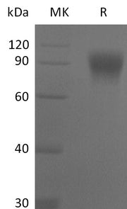 Recombinant Mouse IL-17RA (C-Fc)