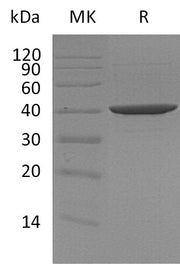 Recombinant Human DNA PolymeraseBeta (C-6His)