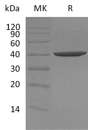 Recombinant Human DNA PolymeraseBeta (C-6His)