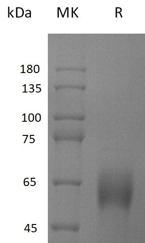 Recombinant Human CD161 (N-Fc)