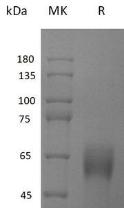 Recombinant Human CD161 (N-Fc)