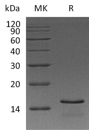 Recombinant Human NPPB (N-6His)
