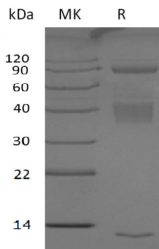 Recombinant Human Latent TGF Beta-1&GARP Complex Protein (N-6His, C-3*Strep)