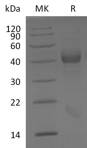 Recombinant Human IL-17RB (C-6His)