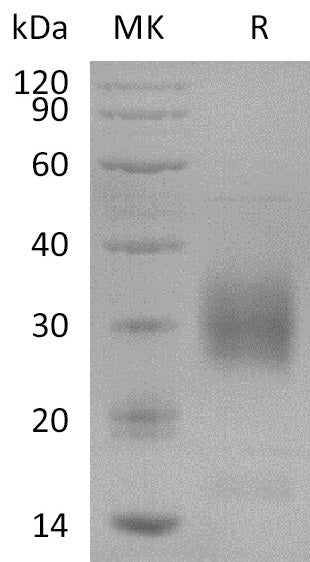 Recombinant Human NKp80 (N-6His)