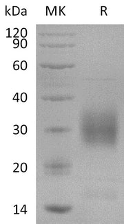 Recombinant Human NKp80 (N-6His)