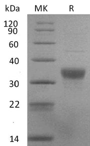 Recombinant Human NKp44 (C-6His)