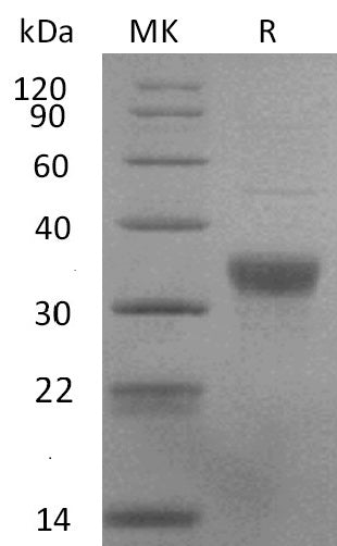 Recombinant Human NKp44 (C-6His)