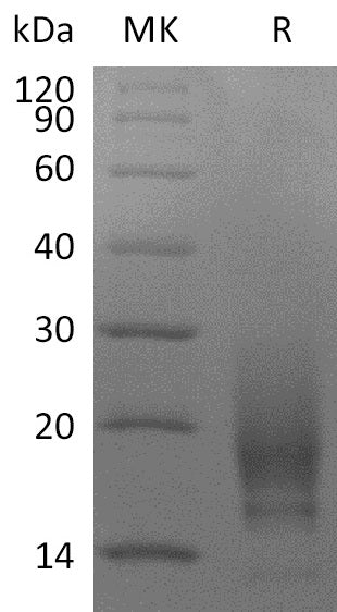 Recombinant Human CD63 (N-6His)