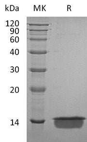 Recombinant Human MIA (C-6His)