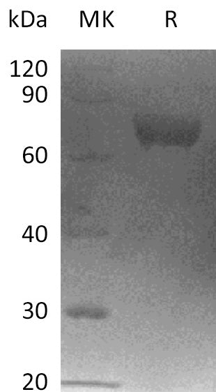 Recombinant Human LRRC15 (C-6His)