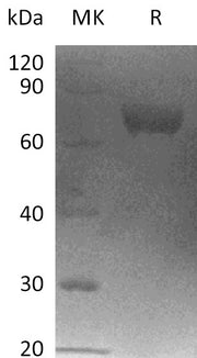 Recombinant Human LRRC15 (C-6His)