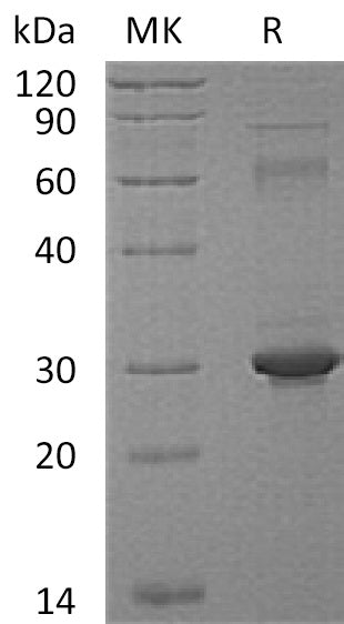 Recombinant Human PPM1G (C-6His)