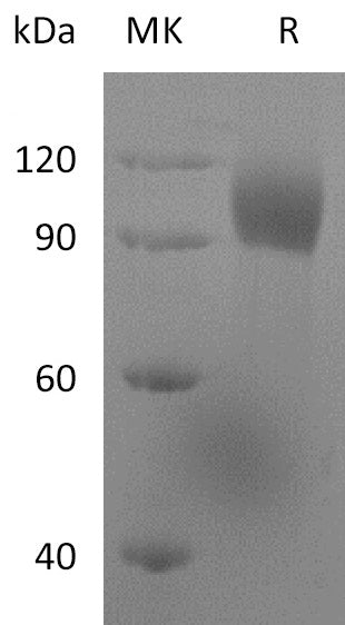 Recombinant Human LILRB1 (C-mFc)