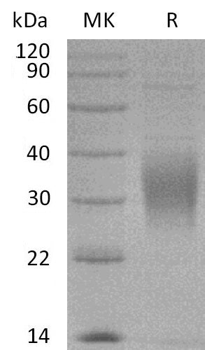 Recombinant Cynomolgus TREM2 (C-6His)