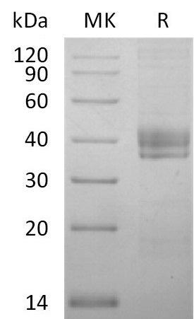 Recombinant Human CTGF (C-6His)