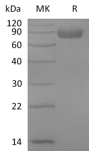 Recombinant Mouse IL-17RD (C-Fc)