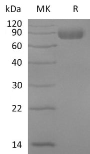 Recombinant Mouse IL-17RD (C-Fc)