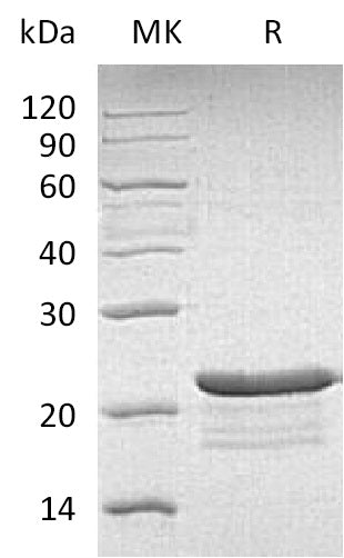Recombinant Human PPP1R14A (C-6His)