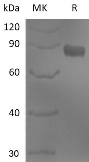 Recombinant Human NTNG1 (C-Fc)