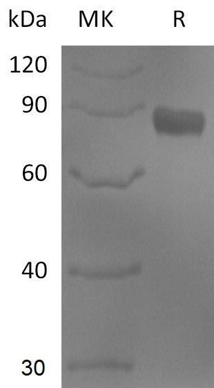 Recombinant Human NTNG1 (C-Fc)