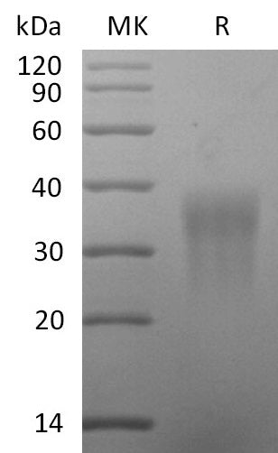 Recombinant Rat CCL2 (C-6His)