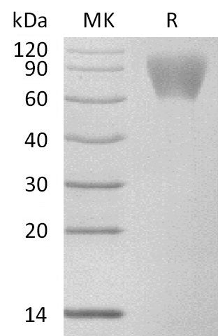 Recombinant Human GUCY2C (C-6His)