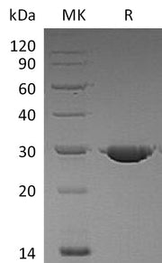 Recombinant Human PSP (C-6His)